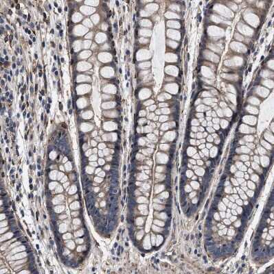 Immunohistochemistry-Paraffin: SQLE Antibody [NBP2-32001]