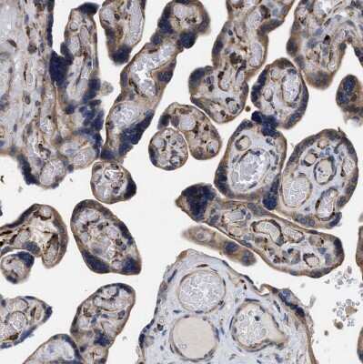 Immunohistochemistry-Paraffin: SQLE Antibody [NBP2-32001]