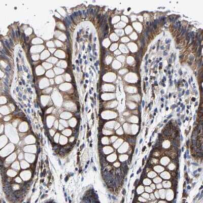 Immunohistochemistry-Paraffin: SQLE Antibody [NBP2-32005]