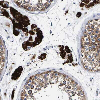 Immunohistochemistry-Paraffin: SQLE Antibody [NBP2-32005]