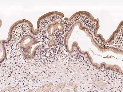 Immunohistochemistry-Paraffin: SQLE Antibody [NBP2-98542]