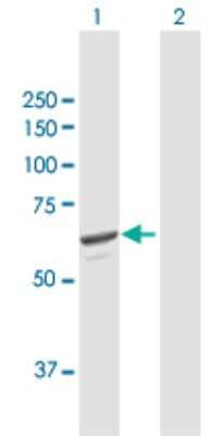 Western Blot: SQLE Antibody [H00006713-B01P]