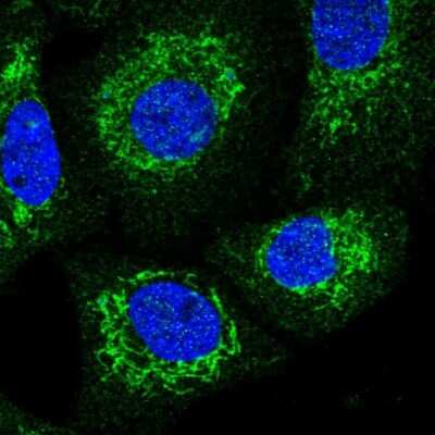 Immunocytochemistry/ Immunofluorescence: SQRDL Antibody [NBP1-84510]