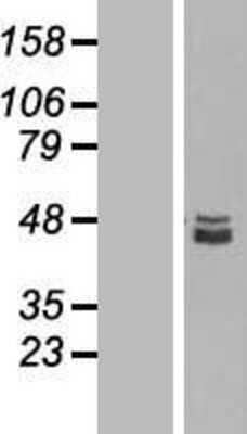 Western Blot: SQRDL Overexpression Lysate [NBL1-16445]