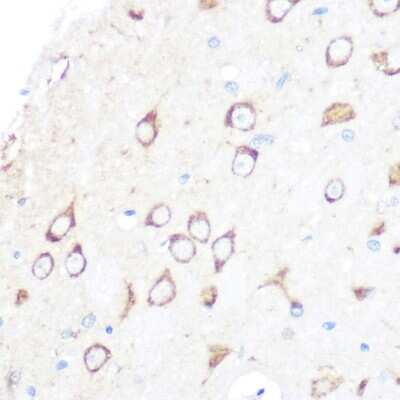 Immunohistochemistry-Paraffin: SR-AI/MSR Antibody (10O8B0) [NBP3-16126]