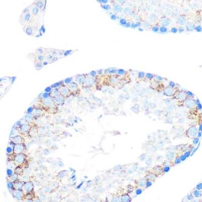 Immunohistochemistry-Paraffin: SR-AI/MSR Antibody (10O8B0) [NBP3-16126]