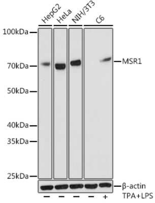 Western Blot: SR-AI/MSR Antibody (10O8B0) [NBP3-16126]