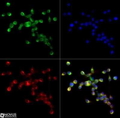 Immunocytochemistry/ Immunofluorescence: SR-AI/MSR Antibody - BSA Free [NBP1-00092]