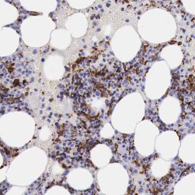 Immunohistochemistry-Paraffin: SR-AI/MSR Antibody [NBP1-88125]