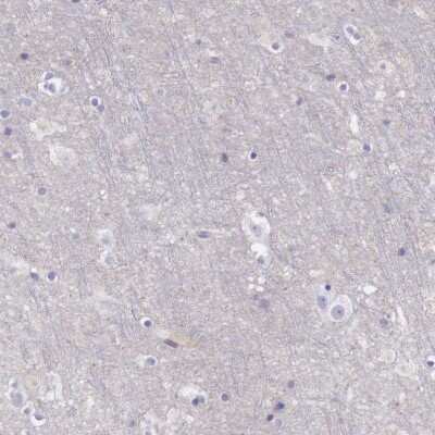 Immunohistochemistry-Paraffin: SR-AI/MSR Antibody [NBP1-88125]