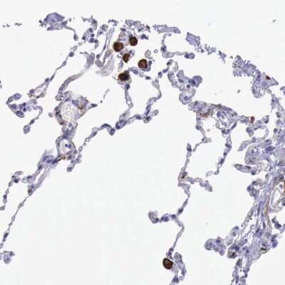Immunohistochemistry-Paraffin: SR-AI/MSR Antibody [NBP1-88125]