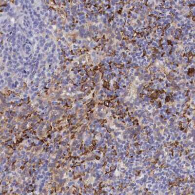 Immunohistochemistry-Paraffin: SR-AI/MSR Antibody [NBP1-88125]
