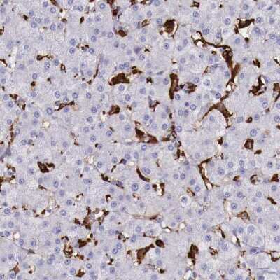 Immunohistochemistry-Paraffin: SR-AI/MSR Antibody [NBP1-88125]