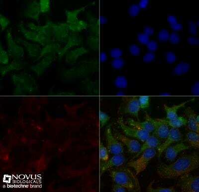 Immunocytochemistry/ Immunofluorescence: SR-BI Antibody - BSA Free [NB400-101]