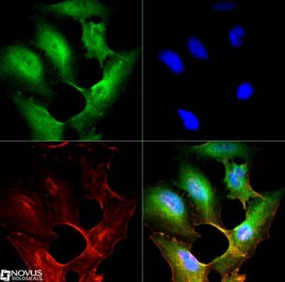 Immunocytochemistry/ Immunofluorescence: SR-BI Antibody [NB400-113]