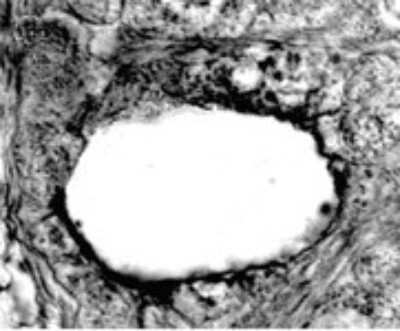 Immunohistochemistry: SR-BI Antibody - BSA Free [NB400-104]