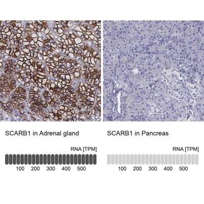 Immunohistochemistry-Paraffin: SR-BI Antibody [NBP2-62676]
