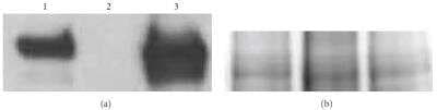 Knockout Validated: SR-BI Antibody - BSA Free [NB400-101]