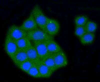 Immunocytochemistry/ Immunofluorescence: SR-BI Antibody (SR37-06) [NBP3-11865]