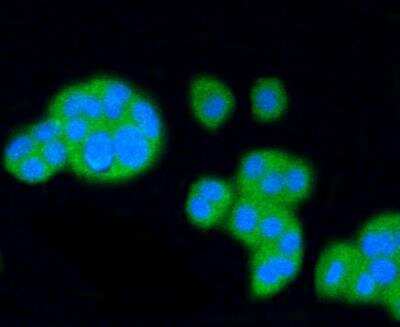 Immunocytochemistry/ Immunofluorescence: SR-BI Antibody (SR37-06) [NBP3-11865]