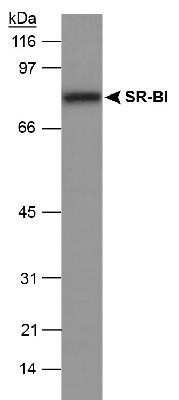 Western Blot: SR-BI AntibodyBSA Free [NB400-101]