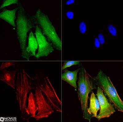 Immunocytochemistry/ Immunofluorescence: SR-BI/SR-BII Antibody [NB400-134]