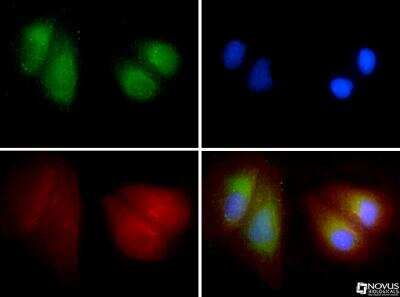 Immunocytochemistry/ Immunofluorescence: LIMPII/SR-B2 Antibody [NB400-102]