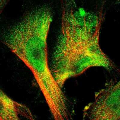 Immunocytochemistry/ Immunofluorescence: SRI Antibody [NBP2-55404]