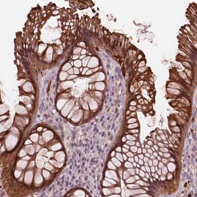 Immunohistochemistry-Paraffin: SRI Antibody [NBP2-55404]