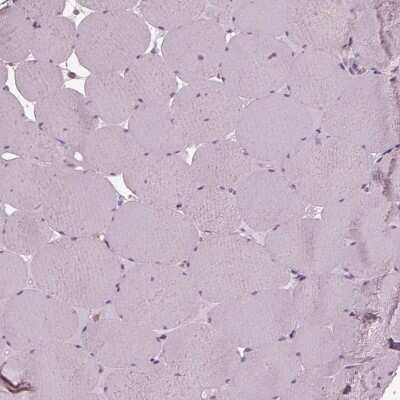 Immunohistochemistry-Paraffin: SRI Antibody [NBP2-55404]