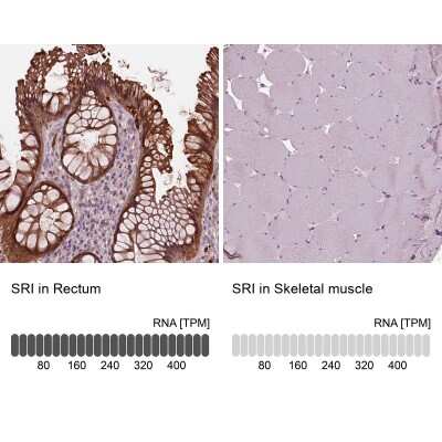 Immunohistochemistry-Paraffin: SRI Antibody [NBP2-55404]