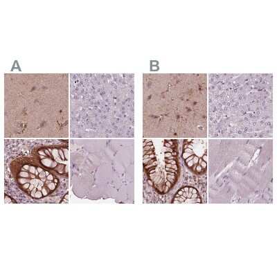 Immunohistochemistry-Paraffin: SRI Antibody [NBP2-55404]
