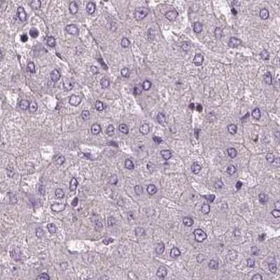 Immunohistochemistry-Paraffin: SRI Antibody [NBP2-55404]