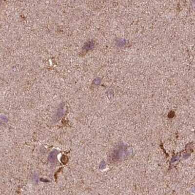 Immunohistochemistry-Paraffin: SRI Antibody [NBP2-55404]
