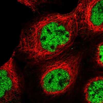 Immunocytochemistry/ Immunofluorescence: SR140 Antibody [NBP1-92444]