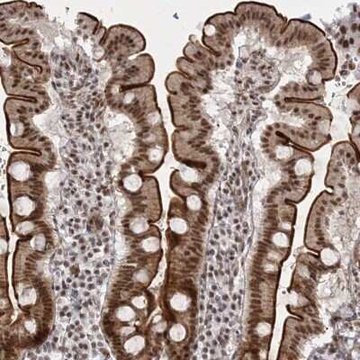 Immunohistochemistry-Paraffin: SR140 Antibody [NBP1-92444]