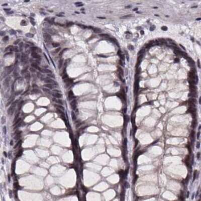 Immunohistochemistry-Paraffin: SR140 Antibody [NBP2-55742]