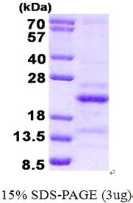SDS-PAGE: Recombinant Human SRA1 His Protein [NBP2-22832]