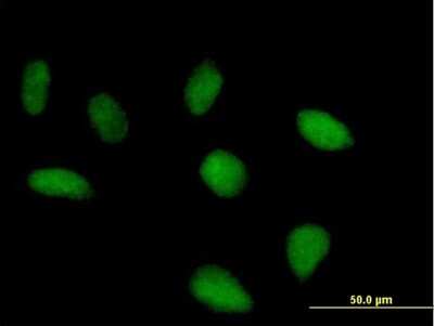 Immunocytochemistry/ Immunofluorescence: SRBD1 Antibody [H00055133-B01P]