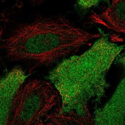 Immunocytochemistry/ Immunofluorescence: SRC1 Antibody [NBP2-55919]