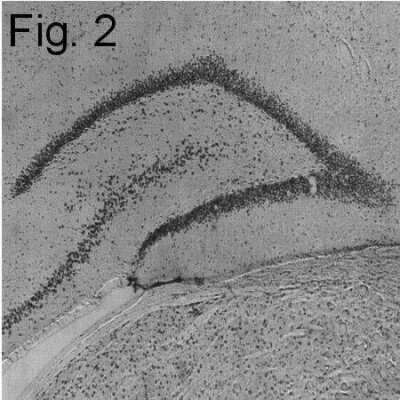 Immunohistochemistry-Frozen: SRC1 Antibody [NB300-541]