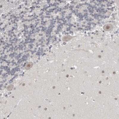 Immunohistochemistry-Paraffin: SRCAP Antibody [NBP1-84063]