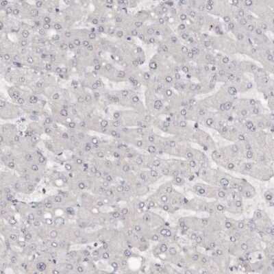 Immunohistochemistry-Paraffin: SRCAP Antibody [NBP1-84063]