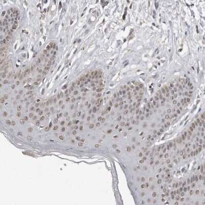 Immunohistochemistry-Paraffin: SRCAP Antibody [NBP1-84063]