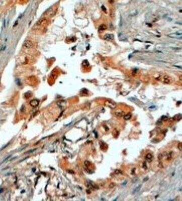 Immunohistochemistry-Paraffin: SRD5A1 Antibody [NB100-1491]