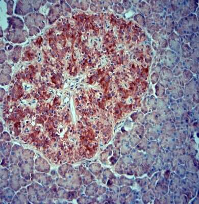 Immunohistochemistry-Paraffin: SRD5A2 Antibody [NBP1-46510]