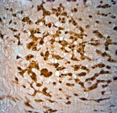 Immunohistochemistry-Paraffin: SRD5A2 Antibody [NBP1-46510]