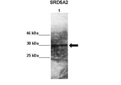 Western Blot: SRD5A2 Antibody [NBP1-59525]