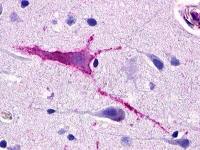 Immunohistochemistry-Paraffin: SREB3 Antibody - BSA Free [NLS527]
