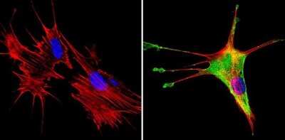 Immunocytochemistry/ Immunofluorescence: SREBP1 Antibody [NB100-74542]